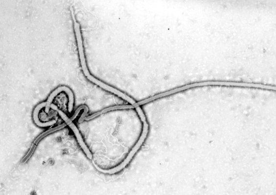 imagen1_Ebola_virus